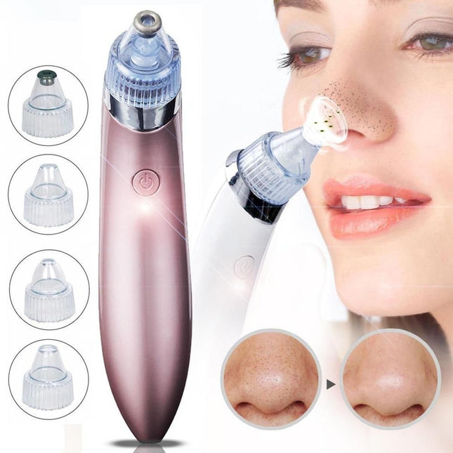 Chargeable Blackhead Removal Machine Black Head Remover Machine - Acne Pimple Pore Cleaner Vacuum Suction Tool Blackhead Removal On Nose